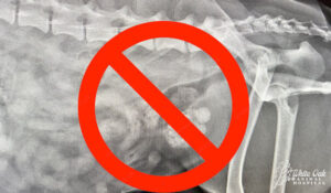 Stones not visible on xray